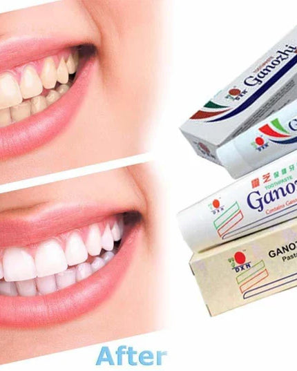 DXN GANOZHI TOOTHPASTE CONTAINS GANODERMA (150 GM)