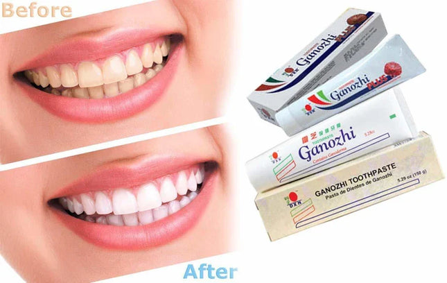DXN GANOZHI TOOTHPASTE CONTAINS GANODERMA (150 GM)