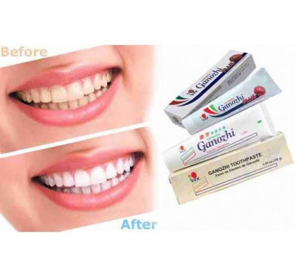 DXN GANOZHI TOOTHPASTE CONTAINS GANODERMA (75 GM)