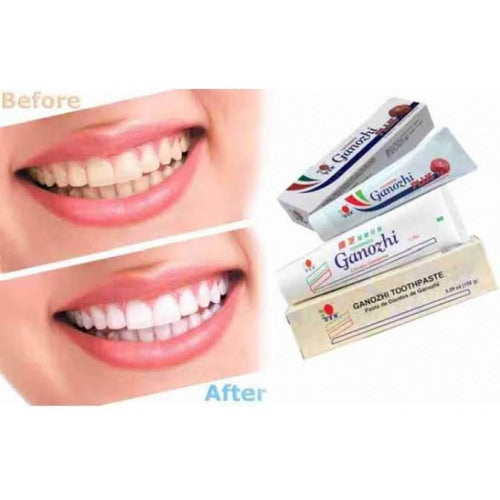 DXN GANOZHI TOOTHPASTE CONTAINS GANODERMA (75 GM)